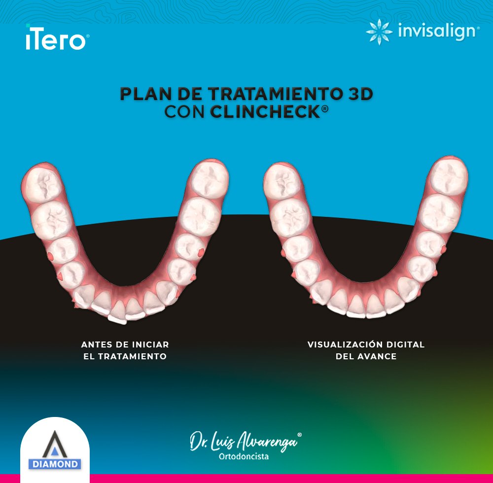 Tratamiento 3D